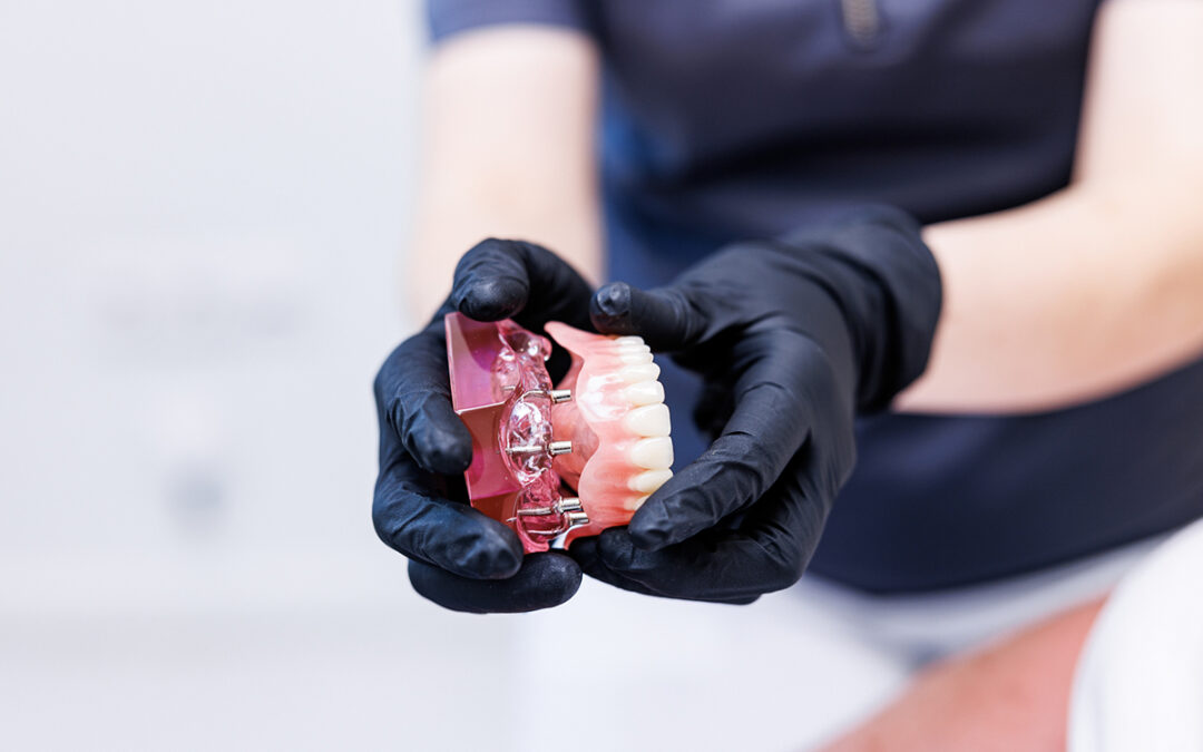 All-on-4 oder Klickprothese? Zwei Lösungen bei völliger Zahnlosigkeit im Vergleich